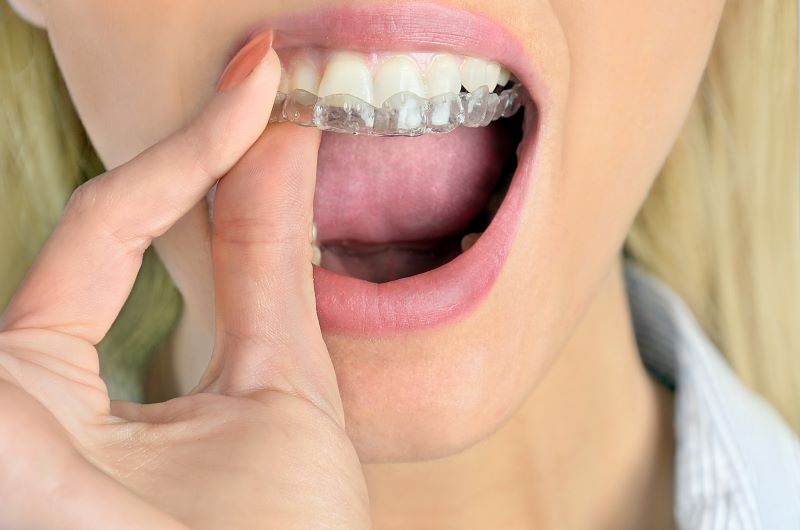 Crown Point Family Dentistry in Charlotte can custom make a mouth guard to help protect your teeth.