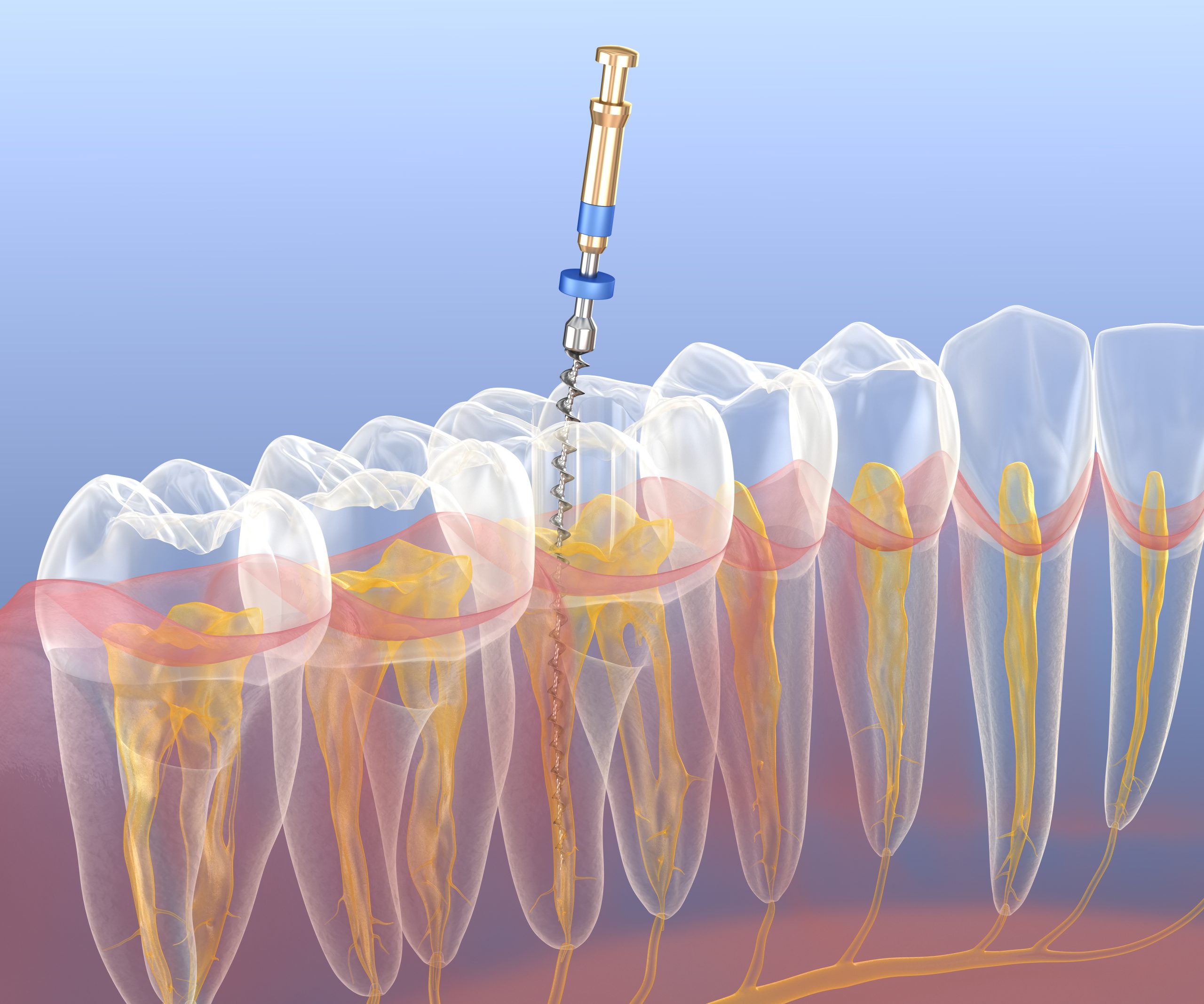 Crown Point root canal myths facts Crown Point root canal myths facts