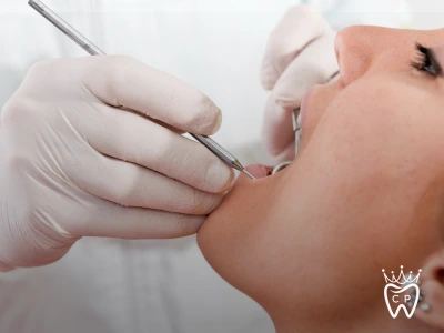 professional-dental-cleaning-plaque-removal dental hygienist performing a professional teeth cleaning to remove plaque buildup