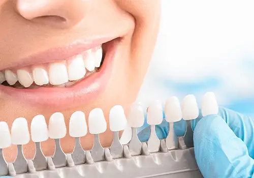 teeth-whitening-charlotte - Crown Point Family Dentistry Professional teeth whitening can help brighten your smile.
